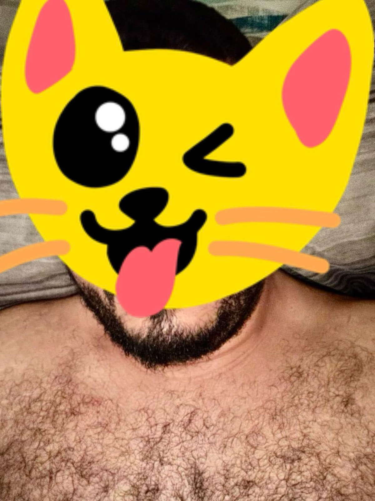 Arm