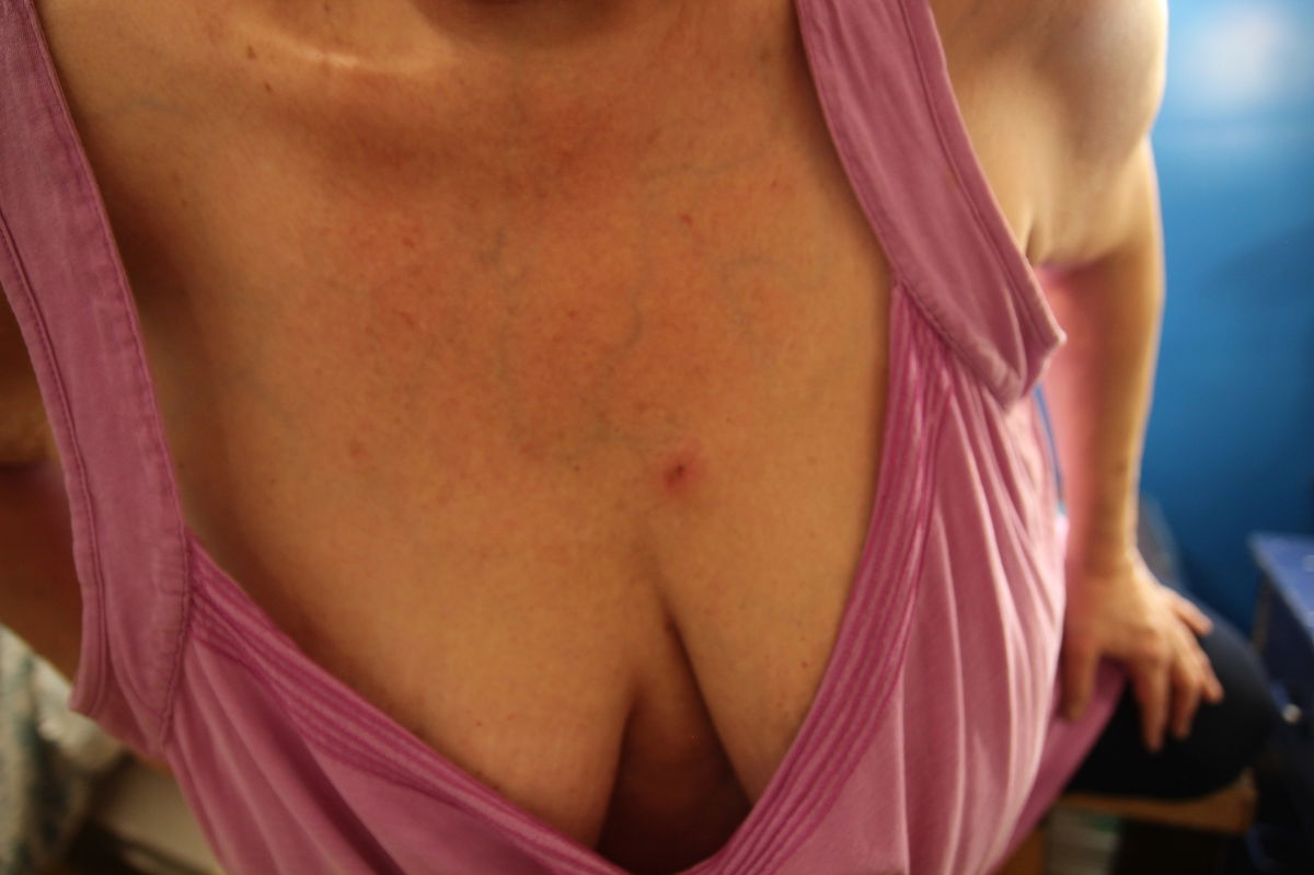 Coquine-Promis