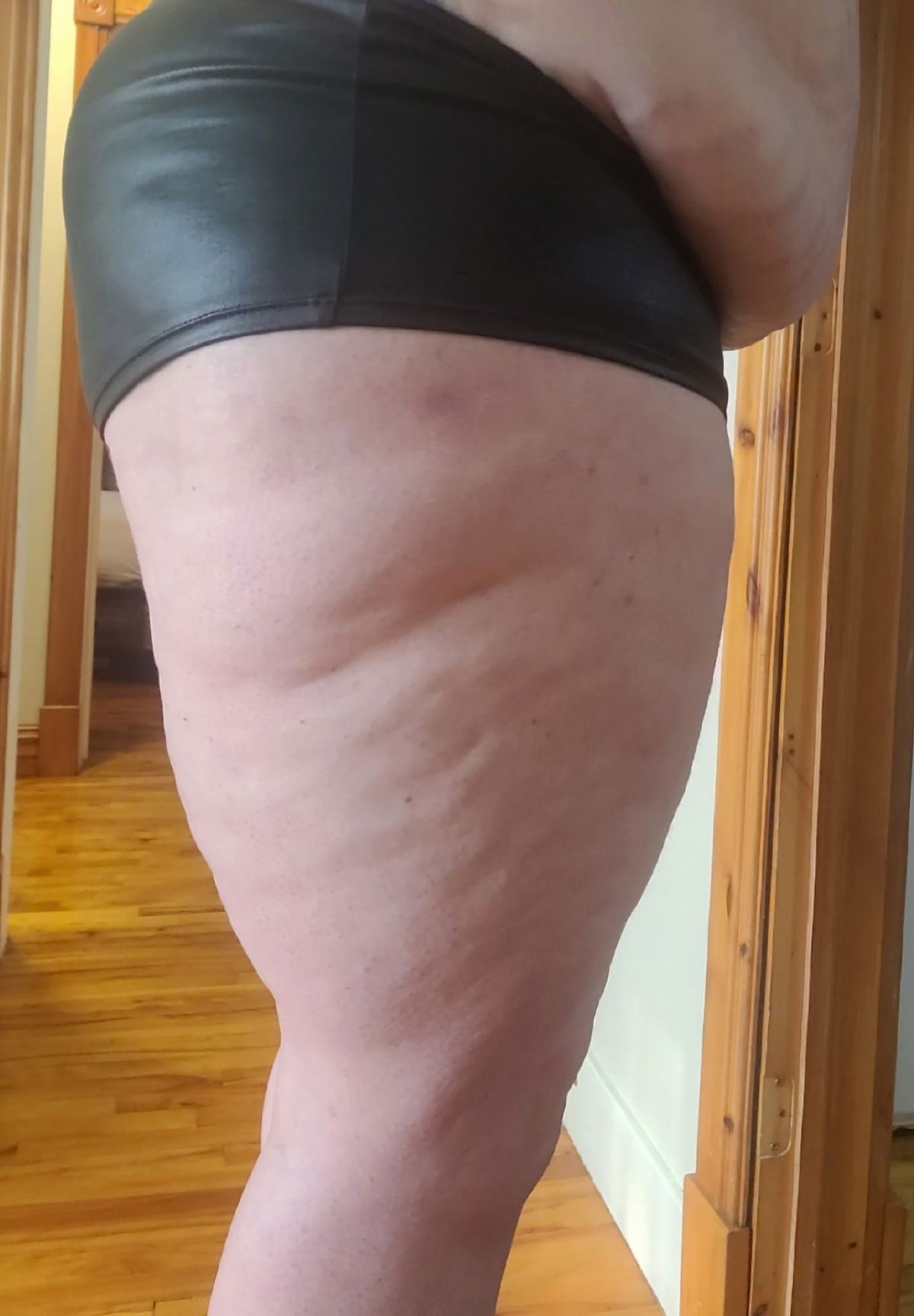 BouleGraisseCelluliteSexy