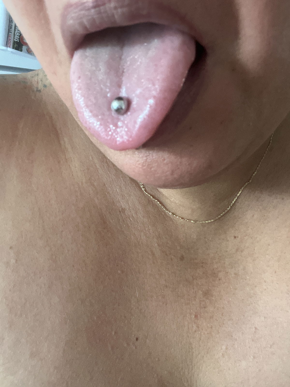 ArielPost-op