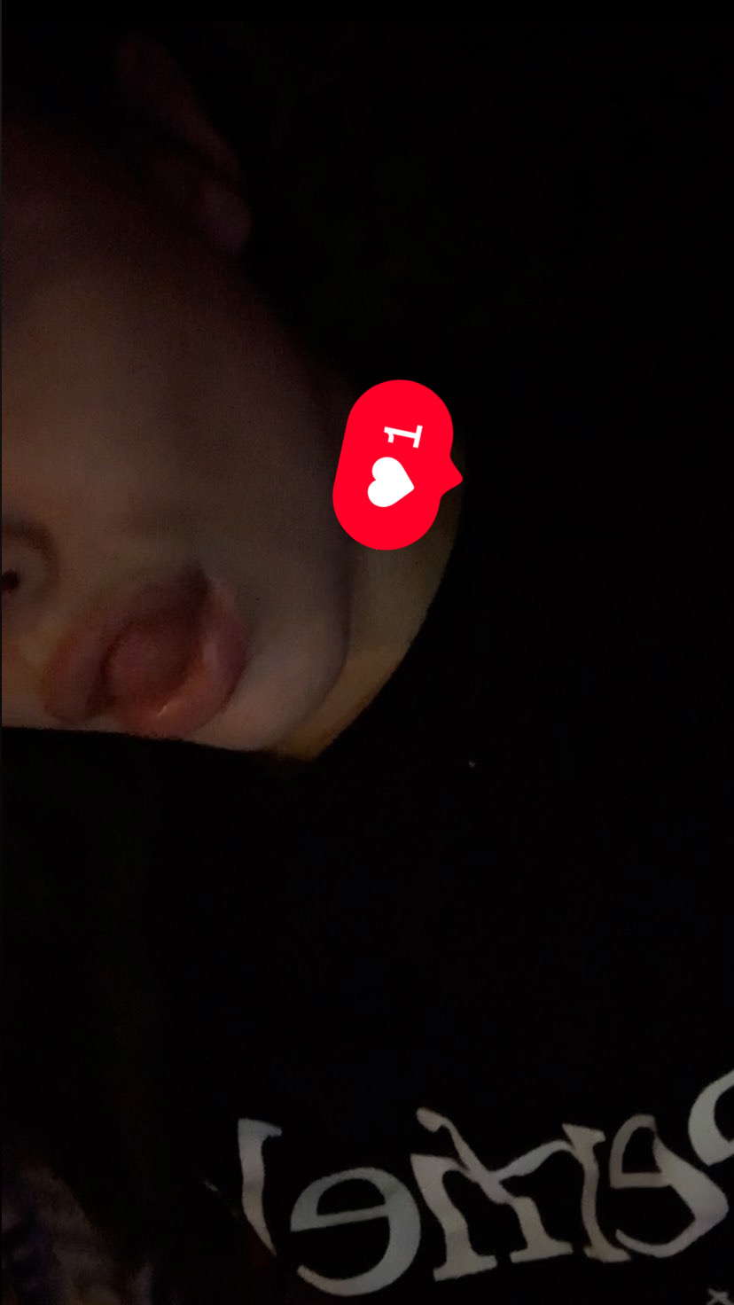 Camillexo